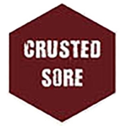 Crusted Sore (18ml) - ARMY PAINTER PAINT